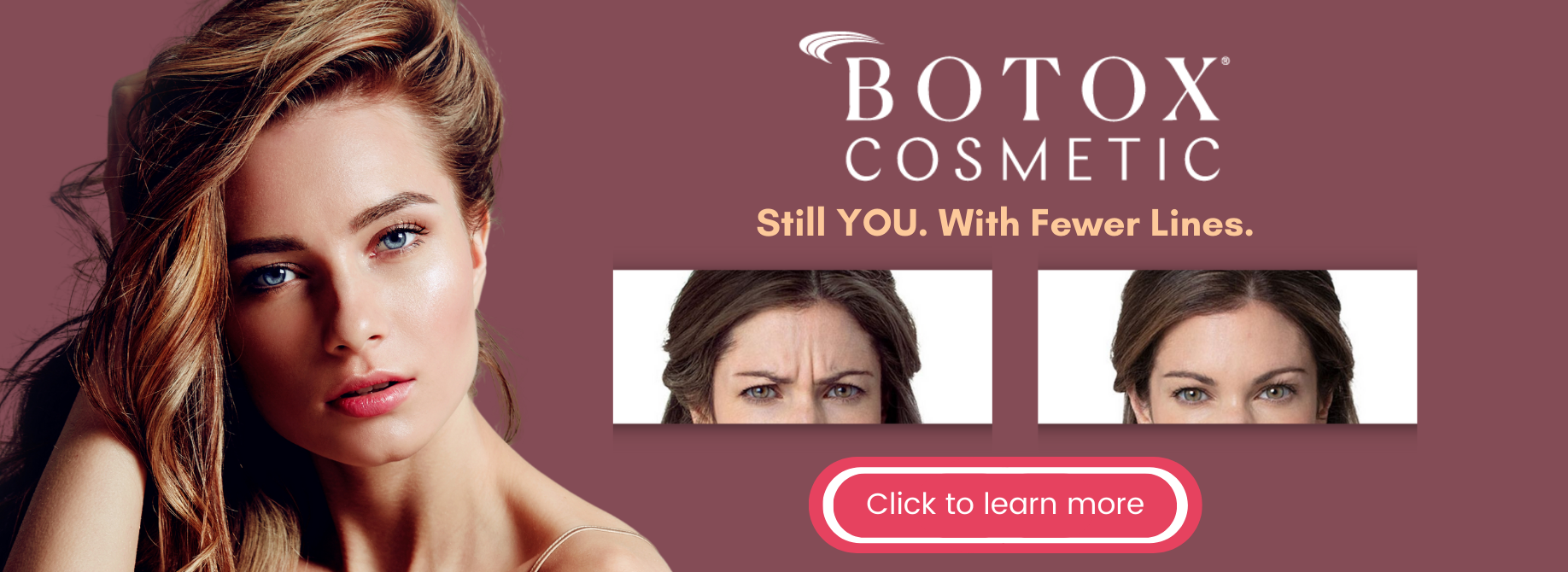 South Tampa Botox Cosmetic